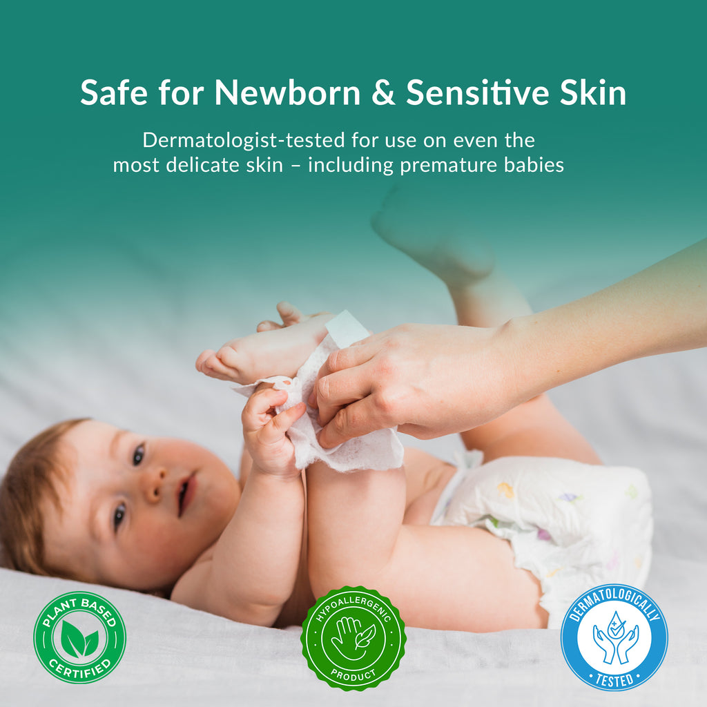 Stopuno Large Wet Wipes 24-Pack Case (1680 Total Wipes)